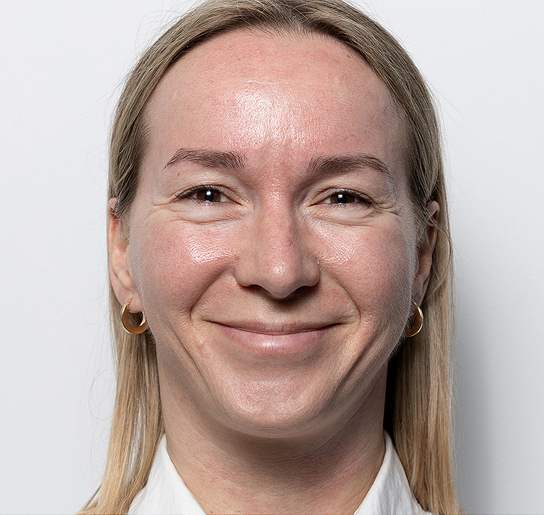 Injekcije za bore, Botox, sl. 1 - prije