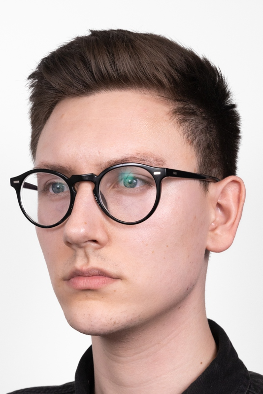 Oblikovanje brade i vilice, sl. 3 - poslije