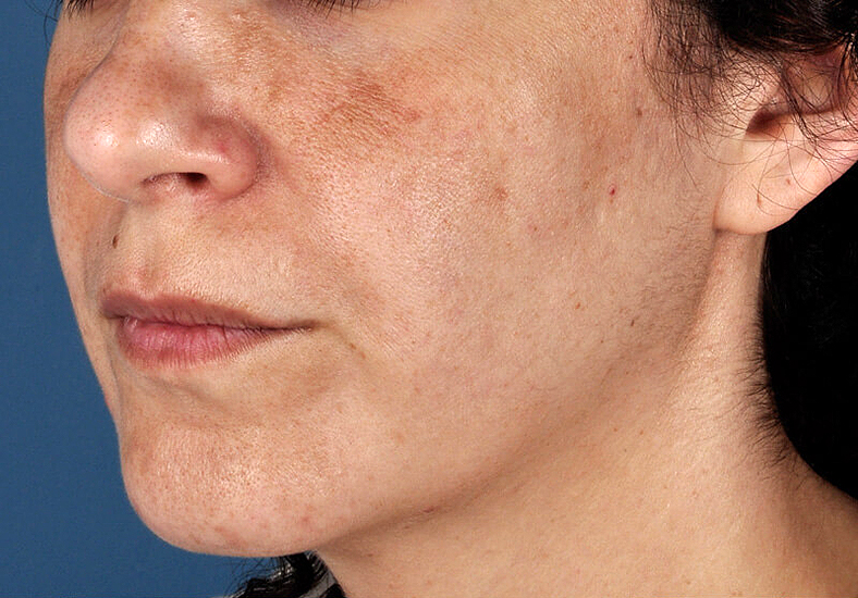 ZO Skin Health, sl. 1 - prije